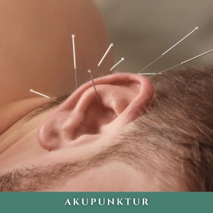 Akupunktur